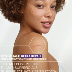 A-Derma Epitheliale Ultra Repair Crema Ristrutturante Anti-Segni con Acido Ialuronico 40ml
