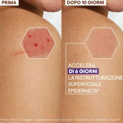 A-Derma Epitheliale Ultra Repair Crema Ristrutturante Anti-Segni con Acido Ialuronico 40ml