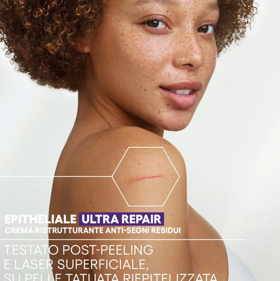 A-Derma Epitheliale Ultra Repair Crema Ristrutturante Anti-Segni con Acido Ialuronico 100ml
