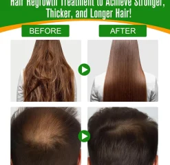 Olio di Batana FSLHCY contro la caduta dei capelli