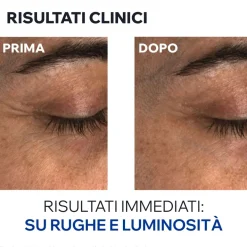 URIAGE AGE ABSOLU Balsamo occhi perfezionatore ridensificante, contorno occhi e palpebra - Risparmia il 10% con il codice: AGE10