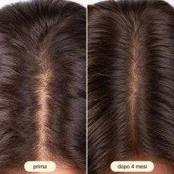 Vitamine Per Capelli con 20 Ingredienti Alto Dosaggio K-Pro Hair Forte