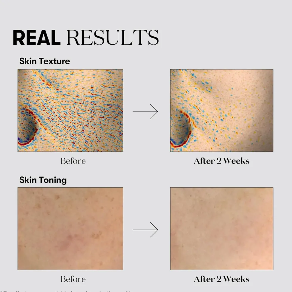 VT COSMETICS TX-Toning Creme